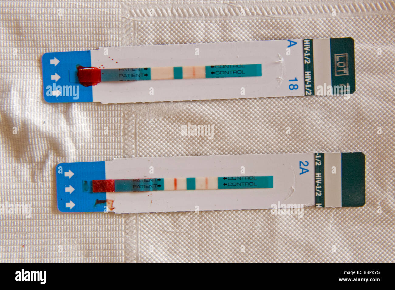 HIV RAPD TESTS